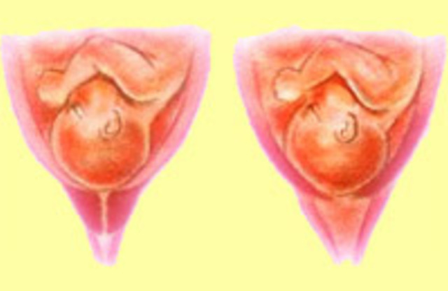 Цервикометрия (УЗИ шейки матки при беременности)